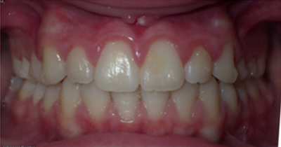 After Orthodontic Service