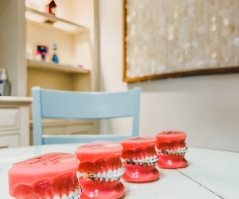 Braces Samples